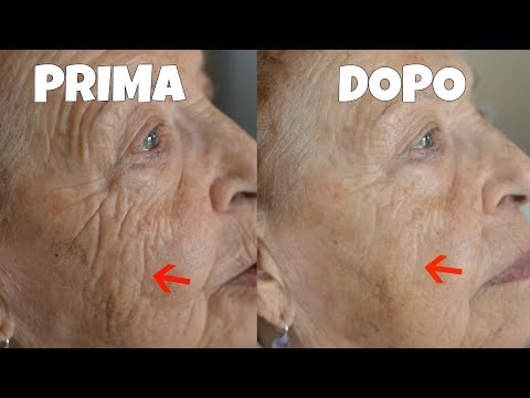 SIERO LIFTING istantaneo FAI DA TE! siero base levigante miracolosa | FUNZIONA