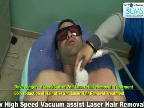 How to get rid of Acne Scars, Tattoo Removal, Los Angeles, How to get rid of Acne Scars, Tattoo Removal, Los Angeles,