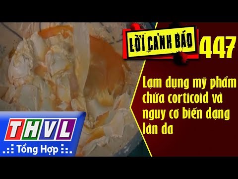 THVL | Lời cảnh báo – Kỳ 447: Lạm dụng mỹ phẩm chứa corticoid và nguy cơ biến dạng làn da