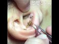 punto negro gigante en la oreja