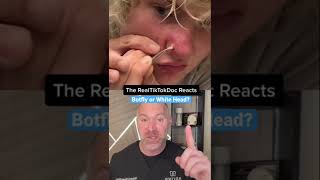 Botfly Or White Head?