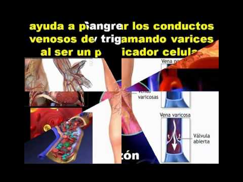 Árbol de Neem: Diabetes Colesterol Gastritis Cáncer neem nim...