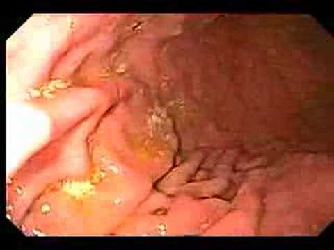 Where Endoscopy in pussy video good Not Endoscopy in pussy video