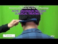 Surgical Removal of Acne Keloidalis Nuchae (AKN)