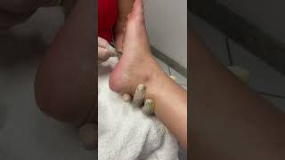 Terapia Podal