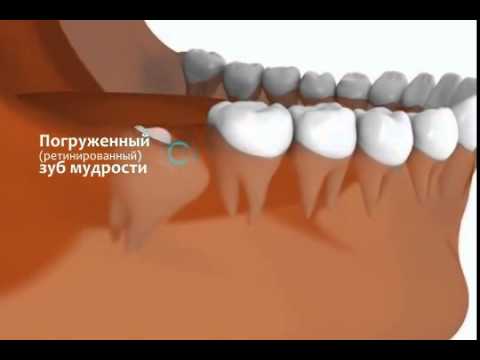 Как быстро снять зубную боль, если болит зуб Женские прически для длинных волос своими