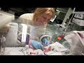 For Every Tiny Hand and Toe: MetroHealth Neonatal Intensive Care Unit (Level III NICU in Cleveland)