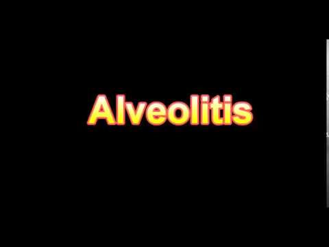 Header of Alveolitis