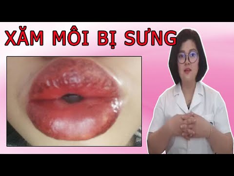 Xăm Môi Bị Sưng Tại Làm Sao