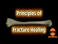 Principles of Fracture Healing