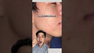 Pov Kalau Sarung Bantal Gapernah Ganti