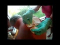 default PIMPLETUBE A site for zit, pimple and cyst popping fans