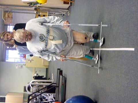 Shortleg Woman On Crutches Vide...