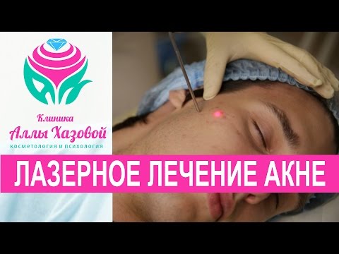 Задать вопрос Глава 19 уход за детьми при инфекционных заболеваниях