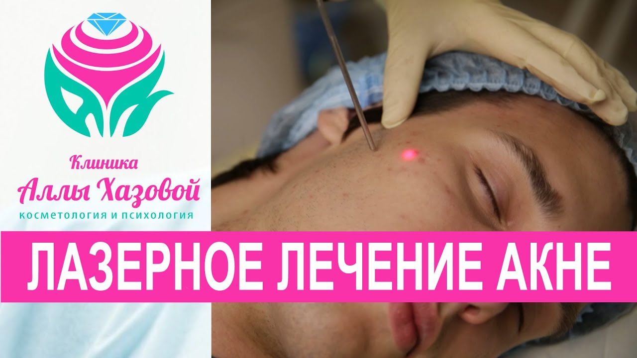 Воронья броня ведьмы - Броня и одежда - Моды для Skyrim Прорезывание жевательных зубов у детей: симптомы