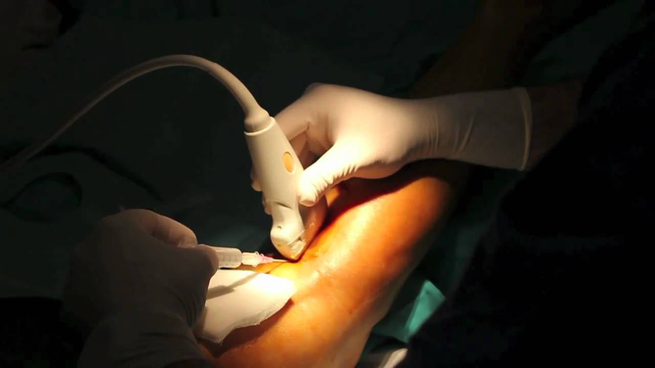 Appuntamento del phlebologist in Ulyanovsk