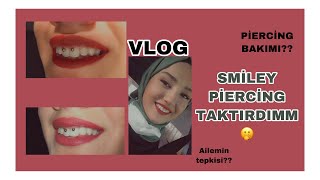 Smi̇ley Pi̇erci̇ng Taktirdim Acıdı Mı?Ailem Ne Tepki Verdi?Piercing Bakımı?
