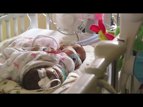 Kylie S Kids U Of M Tech Helps In Twins Kylie S Kids U Of M Tech Helps In Twins