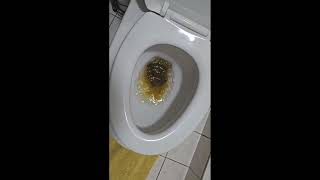 Gy Poop On The Toilet After College