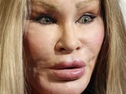Plastic Surgery Disaster(Jocelyn Wildenstein)