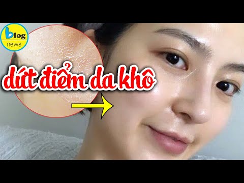 Chăm sóc da khô mùa lạnh như thế nào để da căng mướt