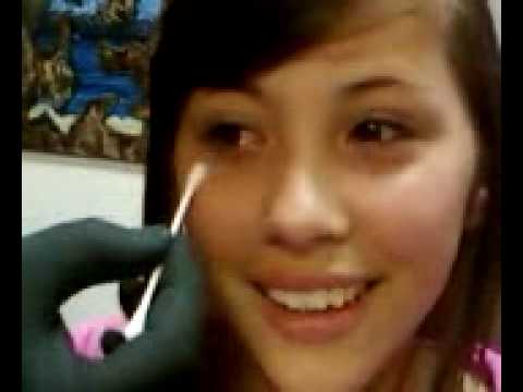 scarring from nose piercing scarring from nose piercing. scarring from nose piercing
