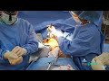 Breast Implants & Tummy Tuck ("Mommy Makeover")- The Park Clinic