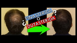 Mejor tratamiento para recuperar pelo perdido