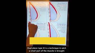 Dekolte Dolgunluğu Dual Plan Tip Iii Dr. Erdem Güven