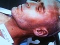 Rare Ted Bundy Autopsy Photo From Electric Chair Execution Florida
