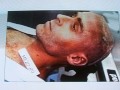 RARE: TED BUNDY AUTOPSY PHOTO FROM ELECTRIC CHAIR EXECUTION FLORIDA