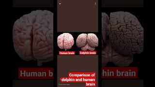 Of Human And Dolphin Brain Shorts