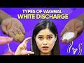 Demo of Vaginal White Discharge💦सफेद पानी योनि से क्यो और कब आता है🤔ये बाते कभी कोई नहीं बताएगा