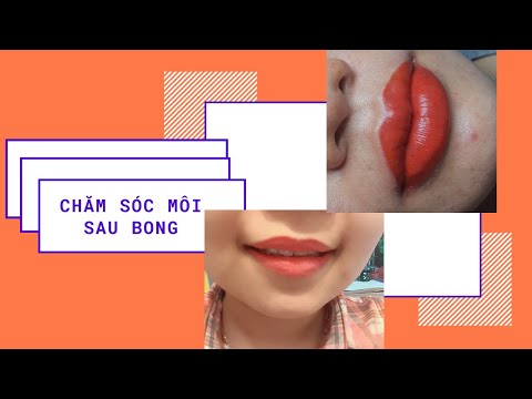 Chăm sóc môi sau bong / Lê Thủy