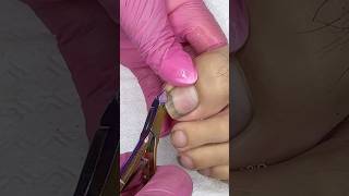 Pedicura