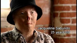 Dangers of Underage Drinking and Driving: Jacqui's Story Dangers of Underage Drinking and Driving: Jacqui's Story