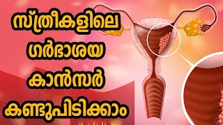 Uterine cancer സ്ത്രീകളിലെ ഗർഭാശയ കാൻസർ കണ്ടുപിടിക്കാം, Health Tips Malayalam