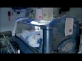 Cancer Patients Treated With Hyperbaric Oxygen