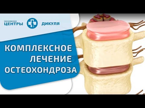 Остеохондроз грудного отдела позвоночника лечение мазями Остеохондроз грудного отдела позвоночника лечение мазями