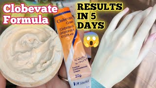 Diy Clobevate Formula Cream For Hands & Feet Whitening Get Fair Hands & Feet In 3 Days Home Remedy