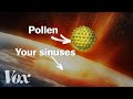 Why your allergies get worse every year