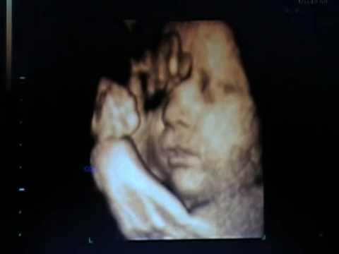 sonogram 5 weeks. 4D ultrasound #5.
