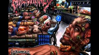 Watch Malignancy Pathological Imperative video