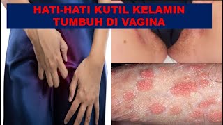 Hati Hati Kutil Kelamin Tumbuh Di