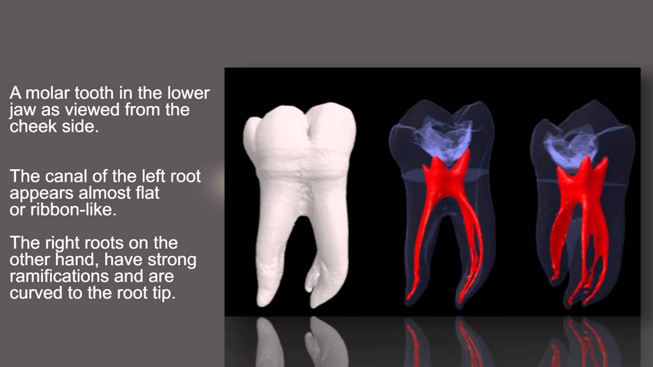 The anatomy of root canals. - YouTube