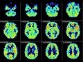 How does the brain generate consciousness? Baroness Susan Greenfield: ANU