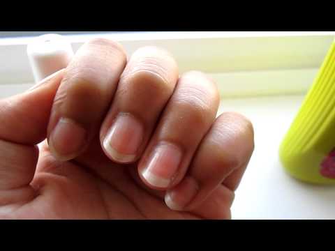  Makeup Remover on How To Grow Long Nails In Less Than 5 Days       Nails Nerang