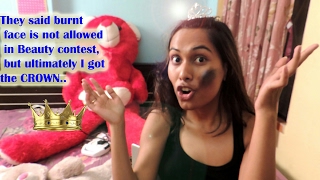 Burnt Girl Struggle First Burnt Beauty Pagent Motivational Story