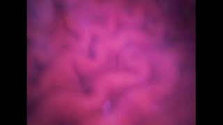 Inside Meh Tum Full Version Endoscope