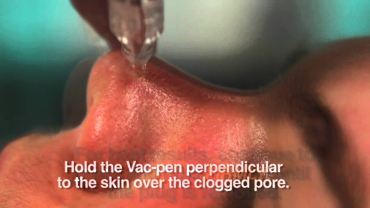 dr vac iskustva blackhead removal strips available in india